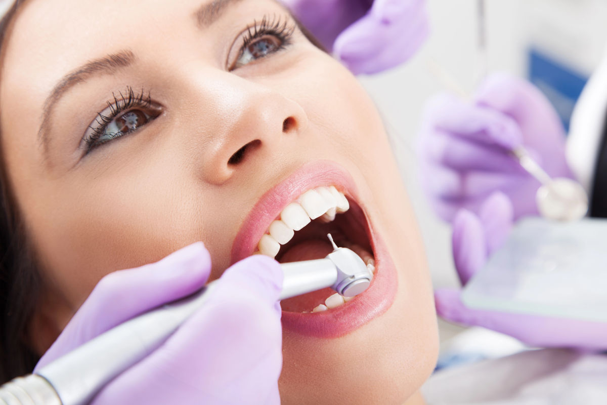 Understanding IPR (Interproximal Reduction) for Invisalign